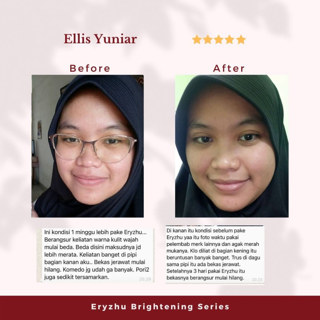 Eryzhu Beauty Indonesia