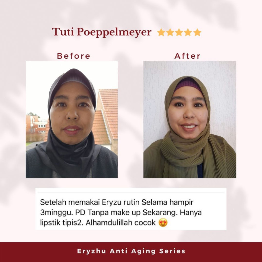 Eryzhu Beauty Indonesia