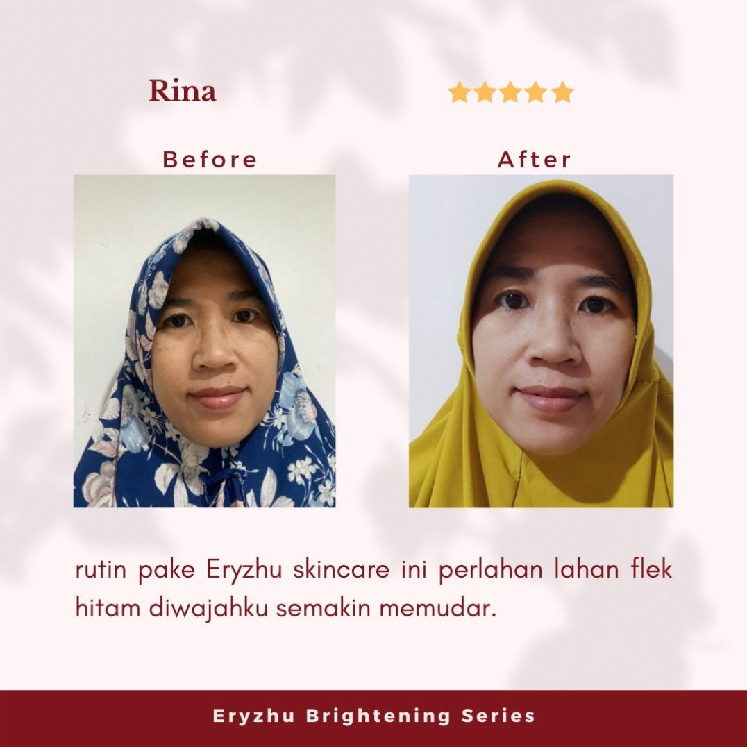 Eryzhu Beauty Indonesia