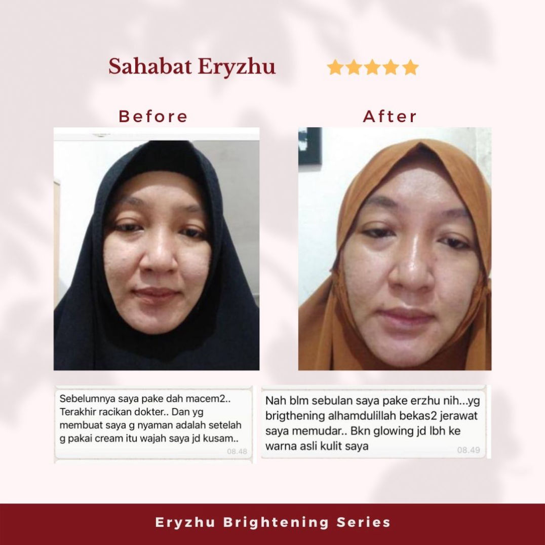Eryzhu Beauty Indonesia