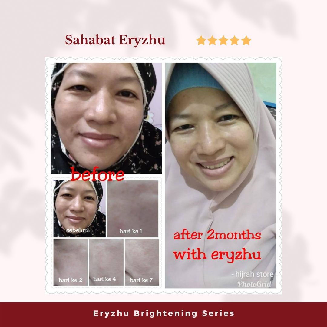 Eryzhu Beauty Indonesia