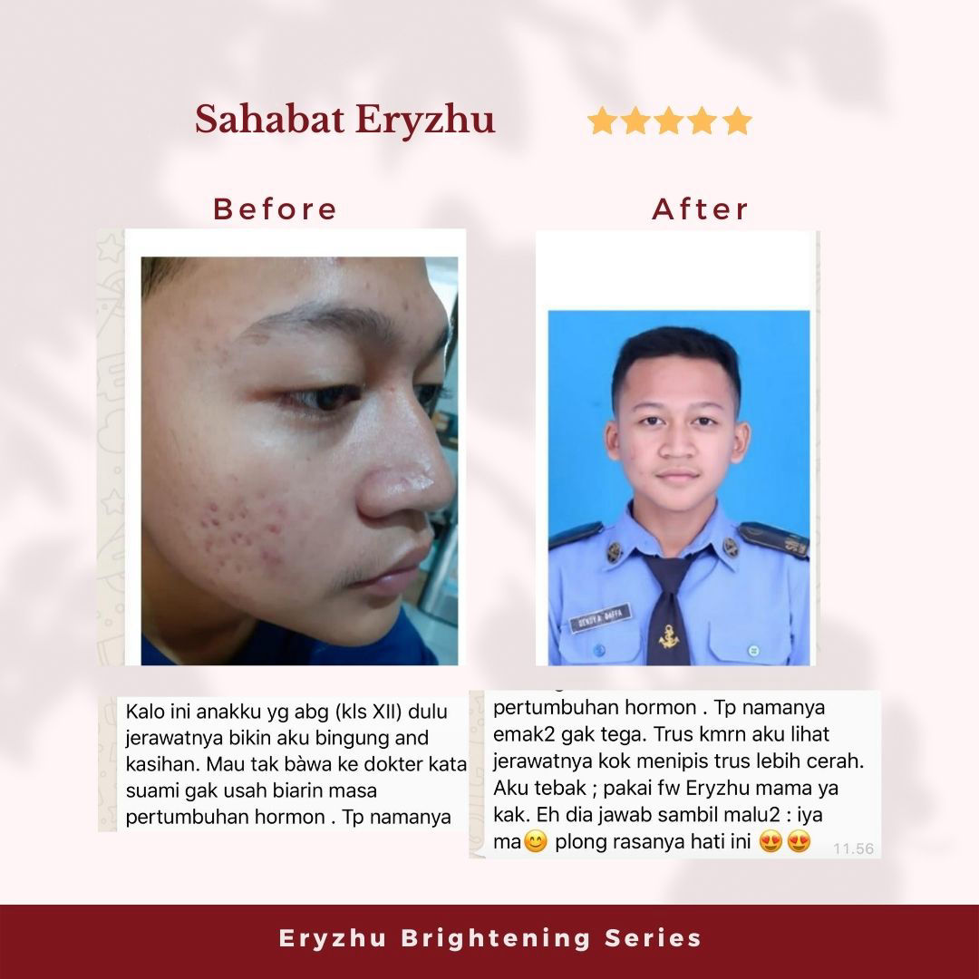 Eryzhu Beauty Indonesia